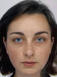 Austrian Baseball Softball Federation