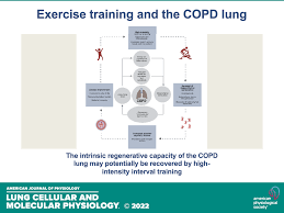 Image result for Exercise in COPD