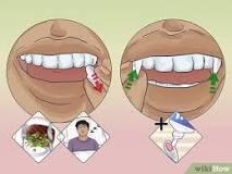 Image result