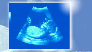 Baby Kino Wie Gefahrlich Ist Ultraschall Furs Kind Wissen Umwelt Dw 17 05 2019