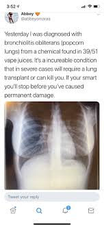 Popcorn lung is not caused by vaping. Besides Vapping What Can Cause Popcorn Lungs Quora