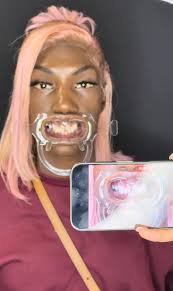 S/o to dr heavenly She really created a miracle for gripbaby teeth because  her shi LOOK GOOD.