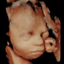 SnapBaby Ultrasounds