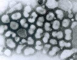 The most common flu hot spots are those surfaces the avian influenza virus causes bird flu. Cum Gia Cáº§m Wikipedia Tiáº¿ng Viá»‡t