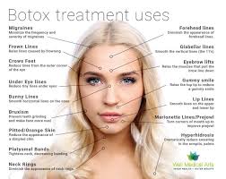 Image Result For Before And After Pictures For Botox For Dao