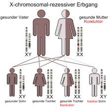 Die väter vererben die krankheit auf all ihre töchter, nie jedoch auf ihre söhne. Erbkrankheit Wikiwand