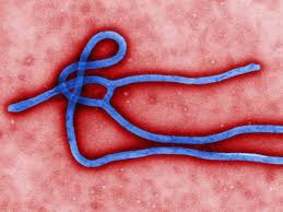 The accident at the secret facility mole 529 where various viruses and vaccines against them were developed. Dentistry And Medicine Ebola Virus Ebola Virus Disease Evd Or Ebola Hemorrhagic Fever Ehf