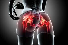 Sitting for prolonged periods of time is particularly damaging, as it shortens and tightens the hip flexors soothe lower back pain with these hip mobility exercises. How To Avoid Hips Pain After Exercise Women Fitness Magazine