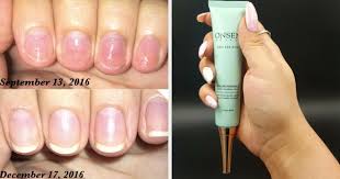 Acrylic nails are the hottest trend and the easiest way to add length and glam to your nails. If You Have Brittle Nails You Need To Try These 12 Products You Can Get On Amazon