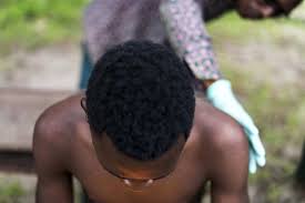 Monkeypox is a rare virus related to smallpox — both belong to a group called orthopoxviruses, which also includes the cowpox virus and the virus used to make the smallpox vaccine (vaccinia). Cdc Scientists Pursue Deadly Monkeypox Virus In Africa Washington Post