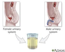 Clean catch urine collection instructions. Urine Culture Information Mount Sinai New York