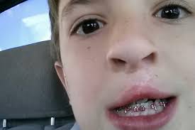 Fundraiser by Becca Culbreath : Dylan and Becca