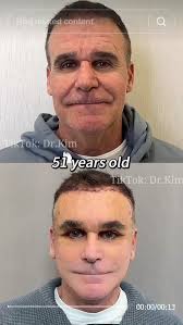 His shocking before and after photos are going viral