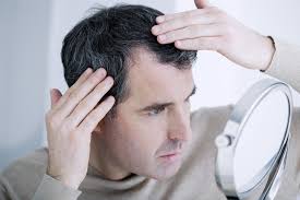 Le taux typique de pousse des cheveux pour un homme adulte est de 1,2 cm par mois. 5 Mythes Sur La Perte De Cheveux Brunet