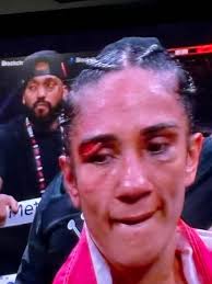 Social Media Is In Shock After Someone Leaked The Alleged “Script” For Mike  Tyson vs. Jake Paul READ MORE:  https://www.totalprosports.com/boxing/social-media-is-in-shock-after-someone-leaked-the-alleged-script-for-mike-tyson-vs-jake-paul/