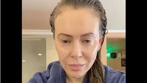 Please add on to the thread with anything i missed! Atteinte Du Coronavirus Alyssa Milano Raconte Son Calvaire Et Sa Perte De Cheveux Midilibre Fr