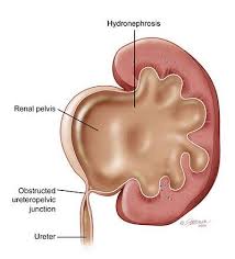 Pin On Health
