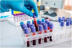 Detect potential kidney cancer through an elevated red blood cell count. New Blood Test Accurately Detects More Than 50 Types Of Cancer