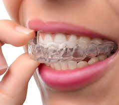 How to whiten you teeth after braces? Teeth Whitening Staines Upon Thames Tooth Whitening Treatment