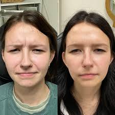 Julia Dameron RN, MSN