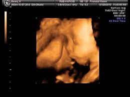 Maybe you would like to learn more about one of these? 3d Ultrasound 27 Weeks Youtube