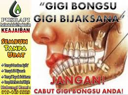 For faster navigation, this iframe is preloading the wikiwand page for gigi geraham. Gigi Bongsu Meaning In English