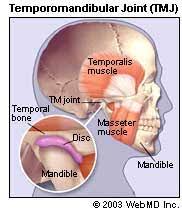 Pain in or around the ear. Temporomandibular Joint Disorders Tmj Tmd Overview