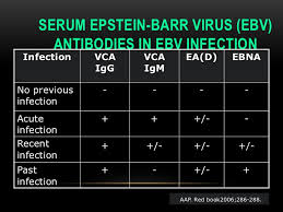 Epstein Barr Virus