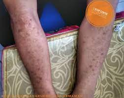 Kl072 dr suraya shafie klinik rantau petronas 24300 kerteh, kemaman, terengganu darul iman. Klinik Syed Badaruddin Kemaman Supply Base Inicio Facebook
