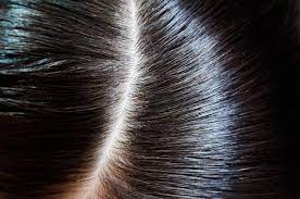 Today we will be answering that question and showing you pictures of lice and nits so you can. Liz S Safe And Foolproof Method To Get Rid Of Head Lice Liz Earle Wellbeing