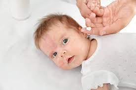 Warum sind babys so oft betroffen? Neurodermitis Beim Baby Symptome Ursachen Behandlung