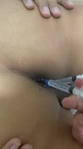 Painful anal injections, the patient whines - ThisVid.com