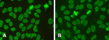 Image result for ANA Staining Pattern