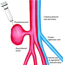 Image result for Pseudoeriosema