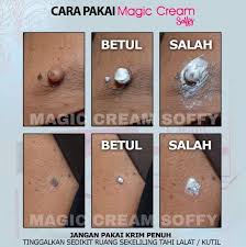 Kolesterol tinggi adalah kondisi kadar kolesterol yang melebihi batas normal dalam tubuh seseorang. Cara Buang Tahi Lalat Ketuat Kutil Biji Kolestrol Dengan Cepat Siaran Facebook