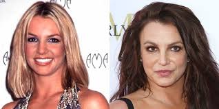 Today, more men are turning to plastic surgery to boost their confidence. Has Britney Spears Had Plastic Surgery Face Before And After