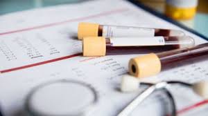 L'augmentation de ce taux dans le sang signifie que la fonction rénale est. Taux De Creatinine Eleve Quelles Sont Les Causes Femme Actuelle Le Mag