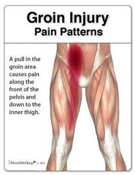 Muscle strain in the groin or buttock. Skyrius Isjungtas Autoritetas Pain In Groin And Down Leg In Female Yenanchen Com