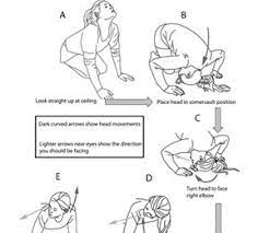 Prevent Vertigo Perform Half Somersault For Dizziness Vertigo Vertigo Treatment Vertigo Symptoms