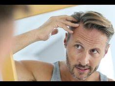 سبب تساقط الشعر علاج تساقط الشعر زراعة الشعر Hair Transplant Women Hair Loss Treatment Shampoo Hair Loss Treatment Vitamins