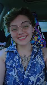 Full mouth teeth extraction and denture experience