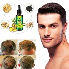 Hair restore biotin hair growth serum is the powerful hair oil which reduces the appearance of thinning, and hair loss. O Carly Hair Growth Serum For Men Women 7days Tonic Ginger Germinal Oil Best Price Online Jumia Kenya