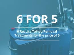 And how does it work? Revlite Laser Tattoo Removal Andrea Catton Laser Clinic