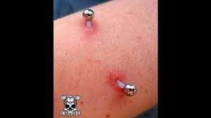 Piercing Rejection Signs Prevention Treatment Pictures And More
