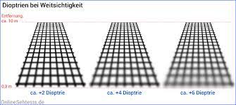 Weitsichtigkeit Hyperopie