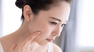 Hilangkan Jerawat Batu Dengan Cara Mudah Beauty Fimela Com