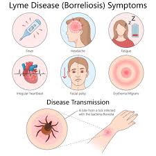 Image result for infected tick bite