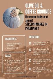 Pin On Pregnancy 101