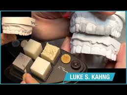 Mock Up Wax Up For The Doctor S Direct Composite Youtube