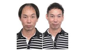 坊主頭はよけいに薄毛が目立つ 美容師が教える薄毛隠し最前線 最速でバレずに気になる薄毛をカバーする ばっちりキマる for men j cast bookウォッチ メンズ ヘアスタイル 薄毛 薄毛ヘアスタイル